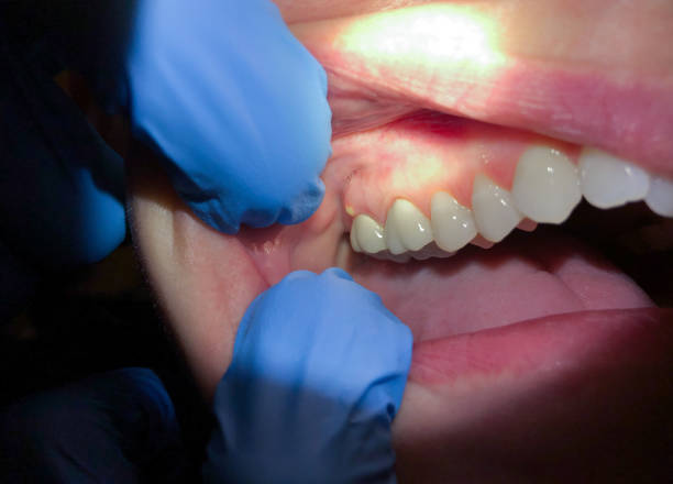 Best Pediatric Emergency Dentist in Lancaster, OH
